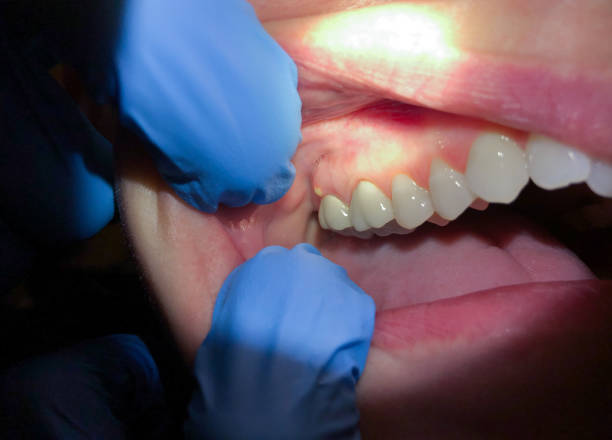 Best Emergency Dental Surgery in Culver, OR