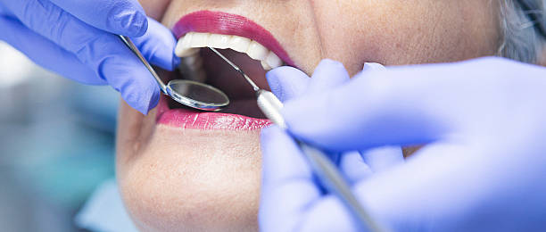 Best Emergency Root Canal Treatment in Culver, OR